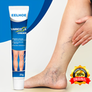 O Creme Poderoso Contra Varizes! Promoção: 50% de Desconto + Frete Grátis!