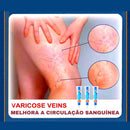 O Creme Poderoso Contra Varizes! Promoção: 50% de Desconto + Frete Grátis!