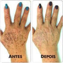 Máscara para as Mãos - RtopR - Acaba com manchas de idade. 50% DE DESCONTO + FRETE GRÁTIS