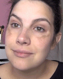 ClareSkin 577 — Spray Removedor de Manchas, Sol, Idade e Melasma! 50% DE DESCONTO + FRETE GRÁTIS!