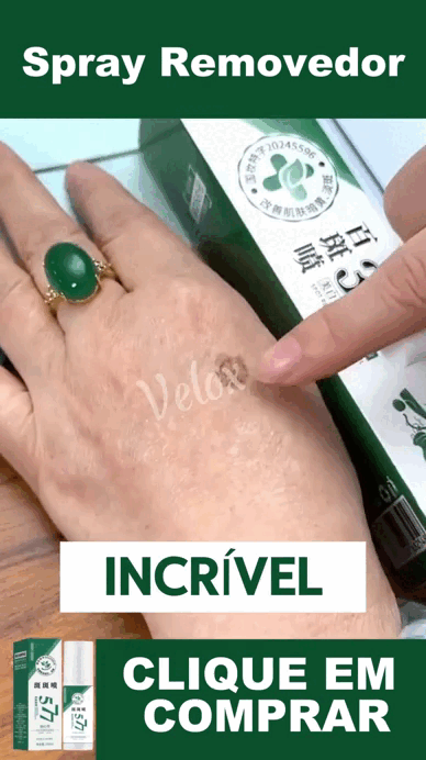 ClareSkin 577 — Spray Removedor de Manchas, Sol, Idade e Melasma! 50% DE DESCONTO + FRETE GRÁTIS!